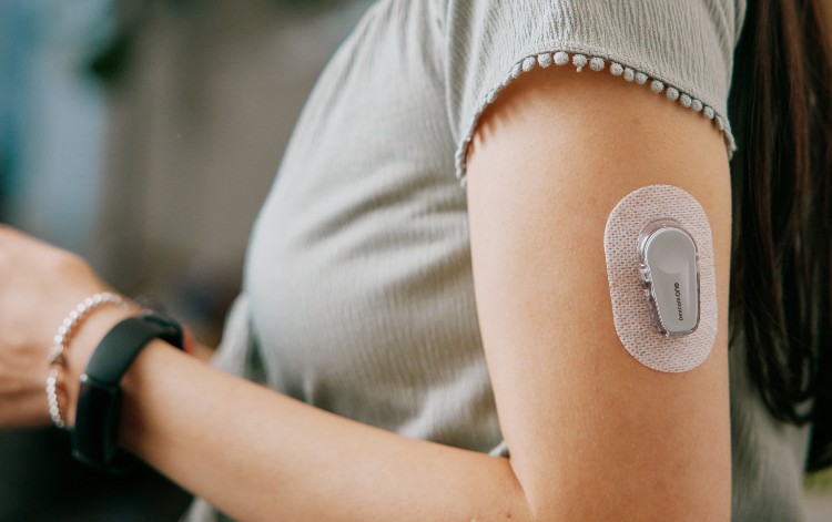 Monitoring Glucose